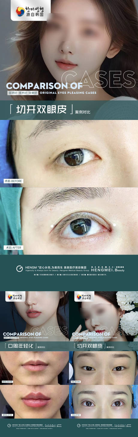 源文件下载【享设计】搜索编号：41600023252143297【医美双眼皮口周年轻化案例】
