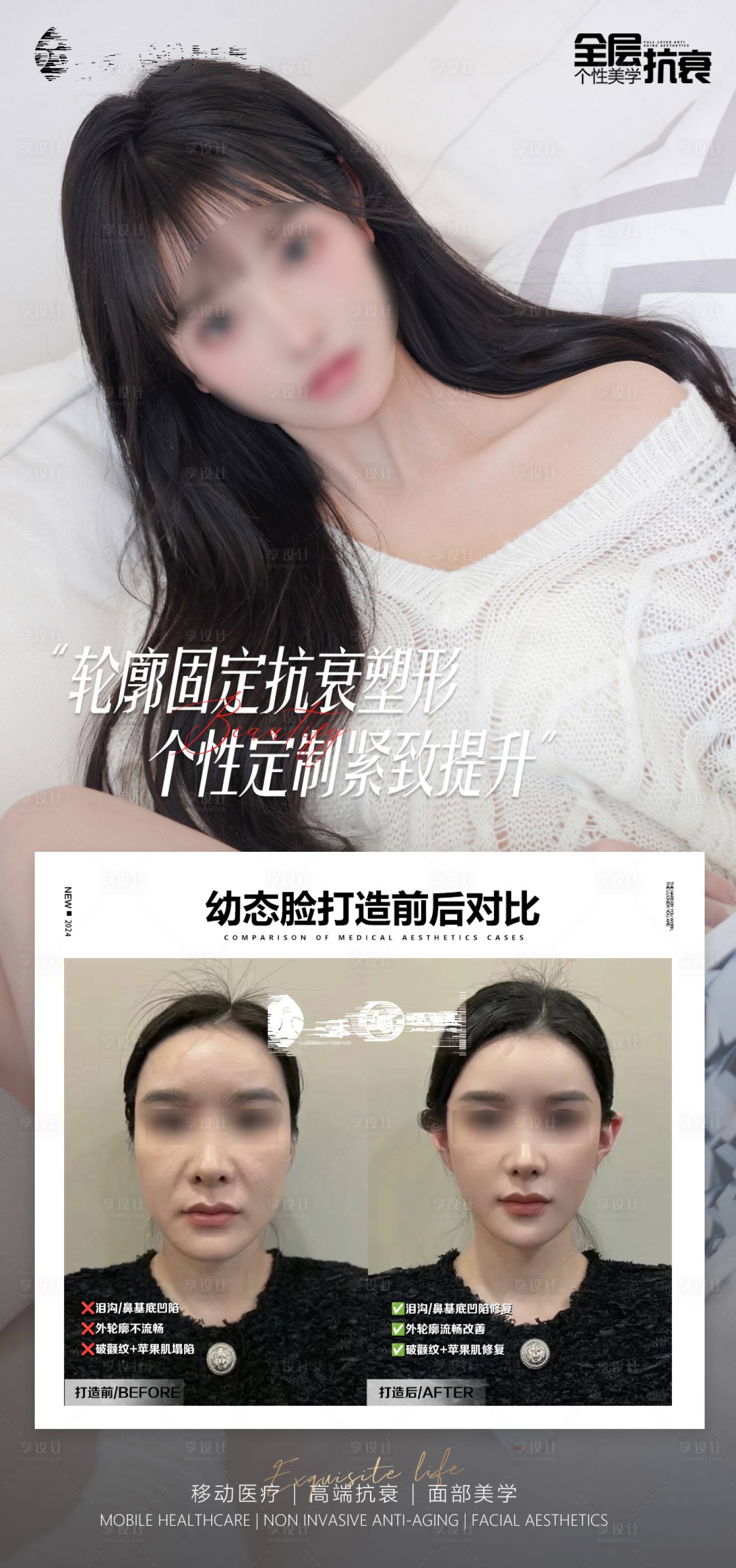 源文件下载【享设计】搜索编号：92560022984085441【医美轻奢高端对比图案例海报】