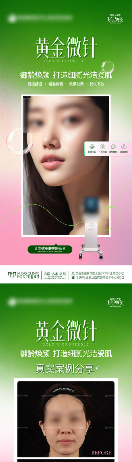 源文件下载【享设计】搜索编号：64530023068915557【医美黄金微针创意科普案例质感简约海报】