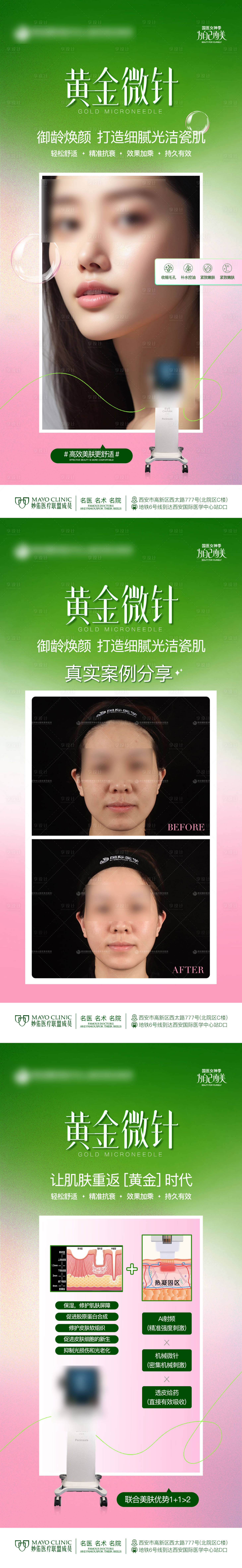 源文件下载【享设计】搜索编号：64530023068915557【医美黄金微针创意科普案例质感简约海报】