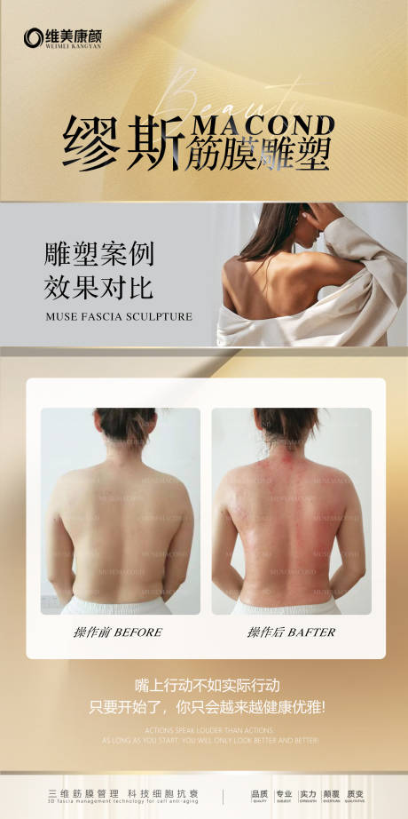 源文件下载【筋膜抗衰对比海报】编号：34710023544585146