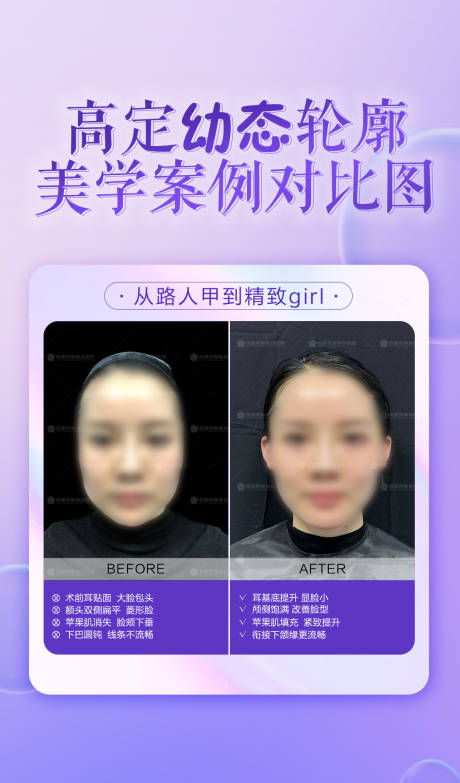 源文件下载【幼态轮廓固定美学案例对比图海报】编号：89470023478469369
