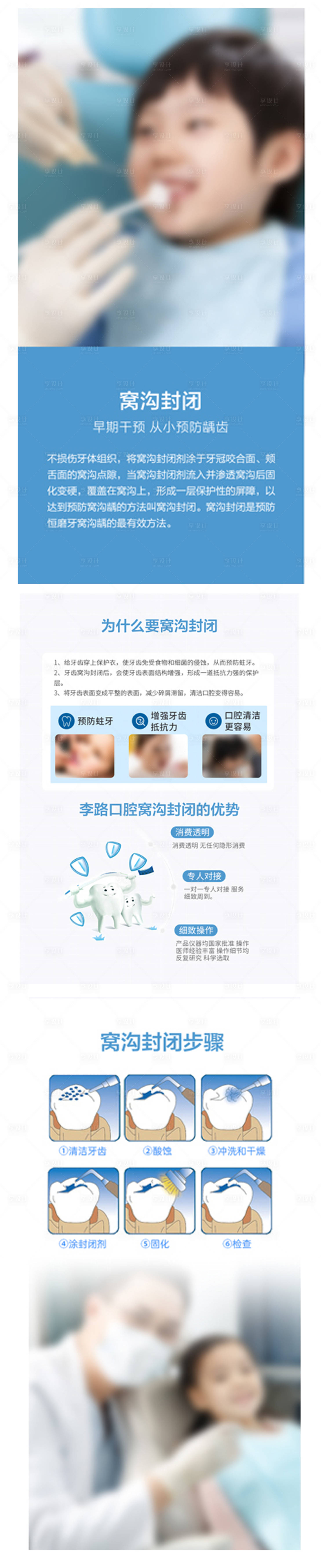 源文件下載【享設計】搜索編號：35170023316936112【口腔醫院窩溝封閉長圖海報】