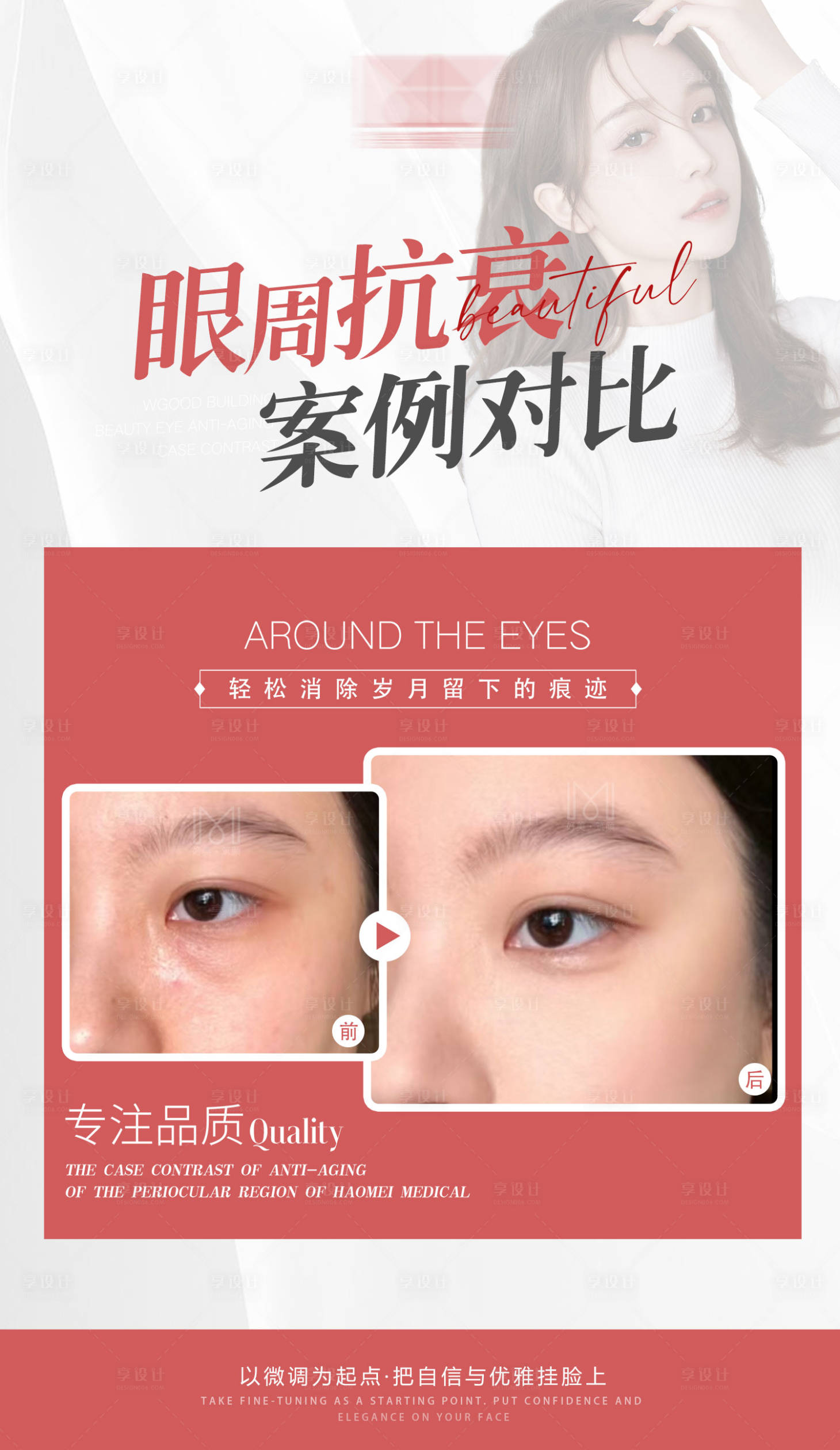 源文件下載【享設計】搜索編號：78740023056959583【醫美案例海報】