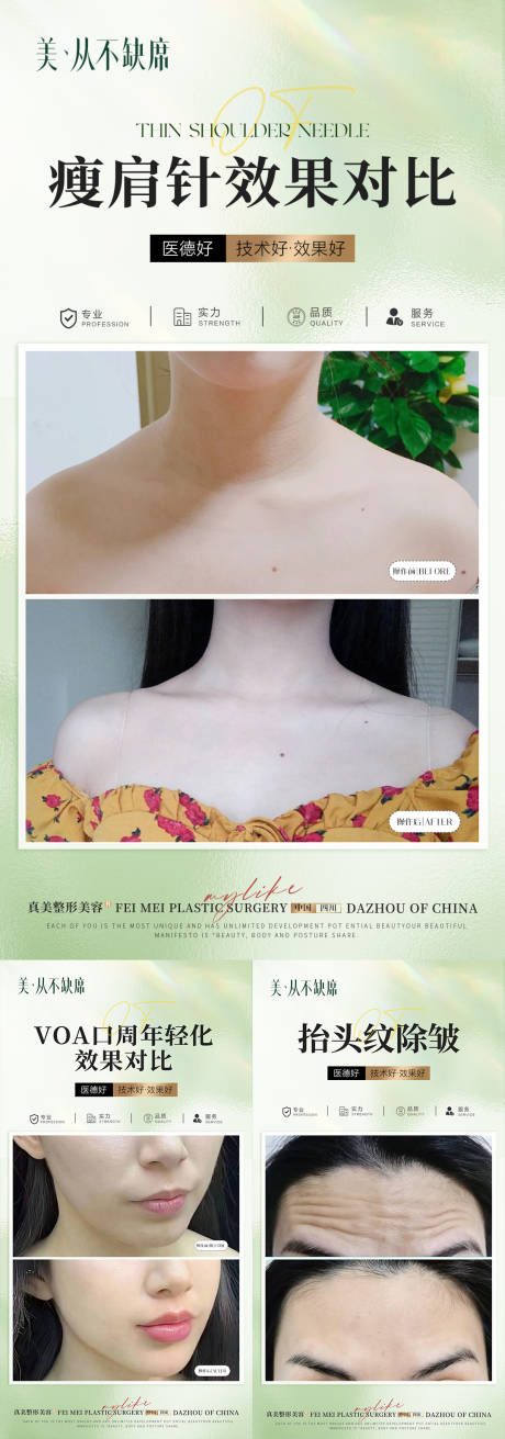 源文件下载【医美海报】编号：33500023206738393