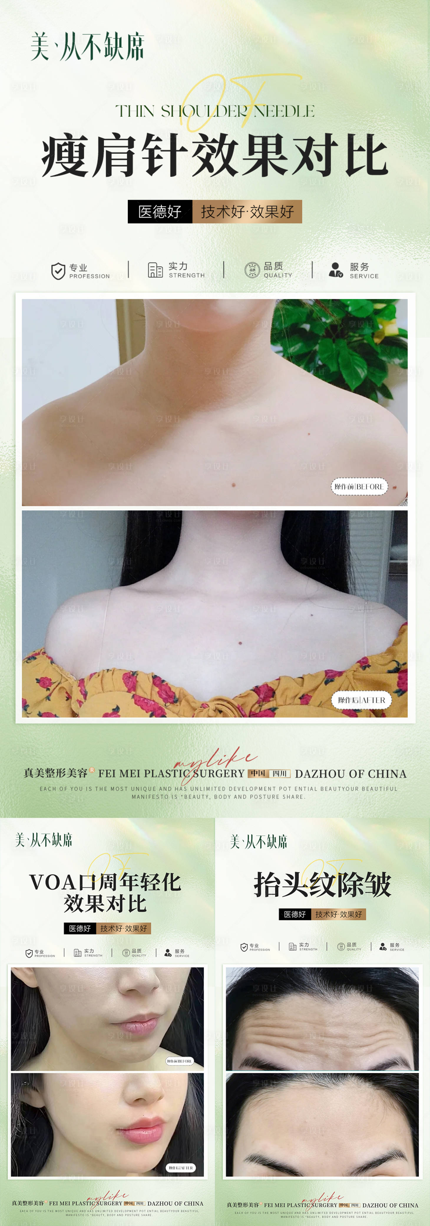 源文件下載【醫美海報】編號：33500023206738393