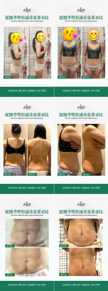 源文件下载【享设计】搜索编号：22390023327753736【医美瘦身形体案例海报】