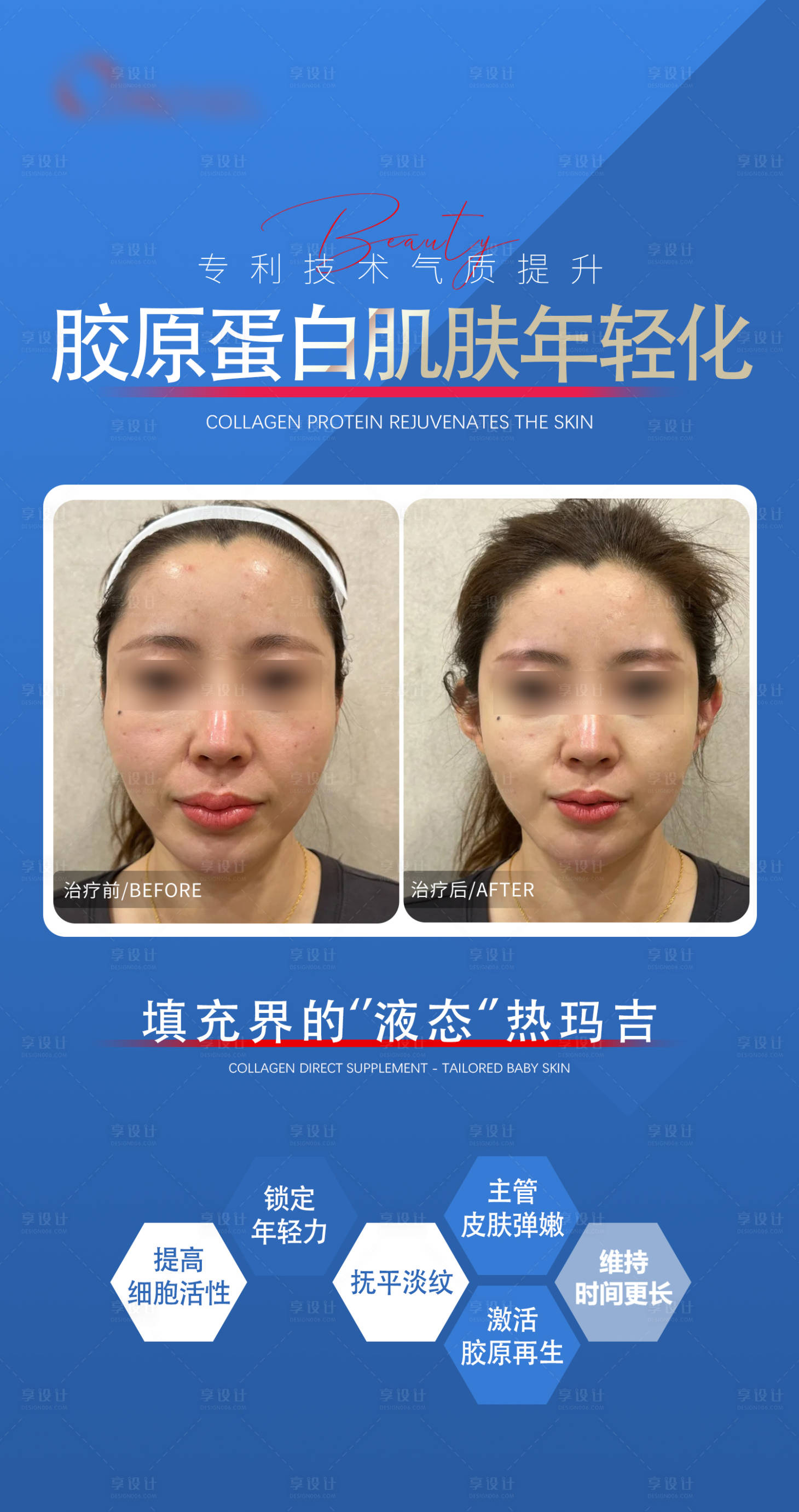 源文件下載【享設計】搜索編號：17920023537347925【膠原蛋白對比海報】