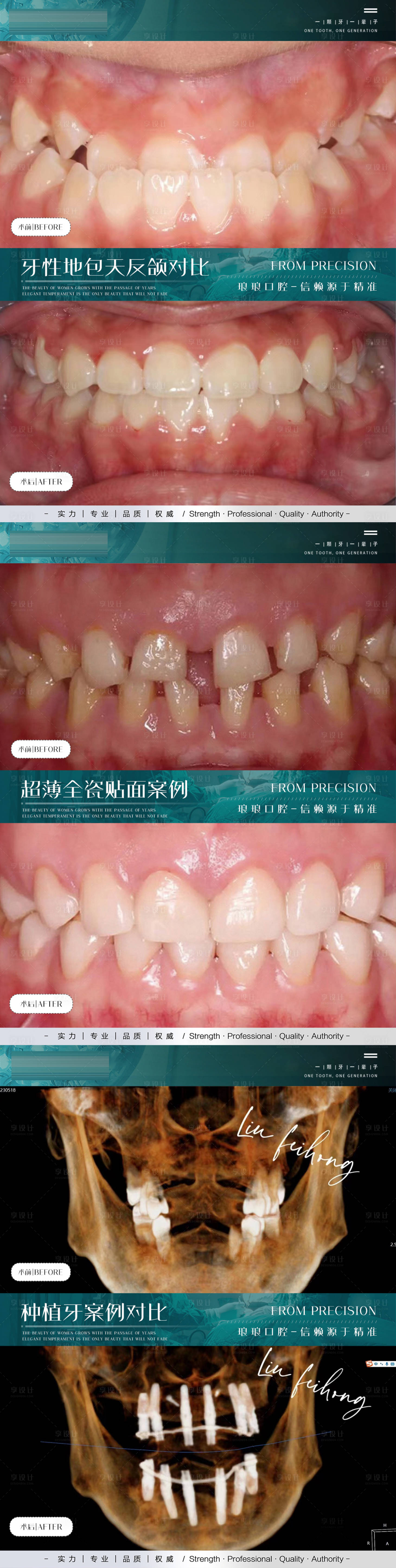 源文件下載【享設計】搜索編號：53620023368632730【口腔案例對比系列海報展板】