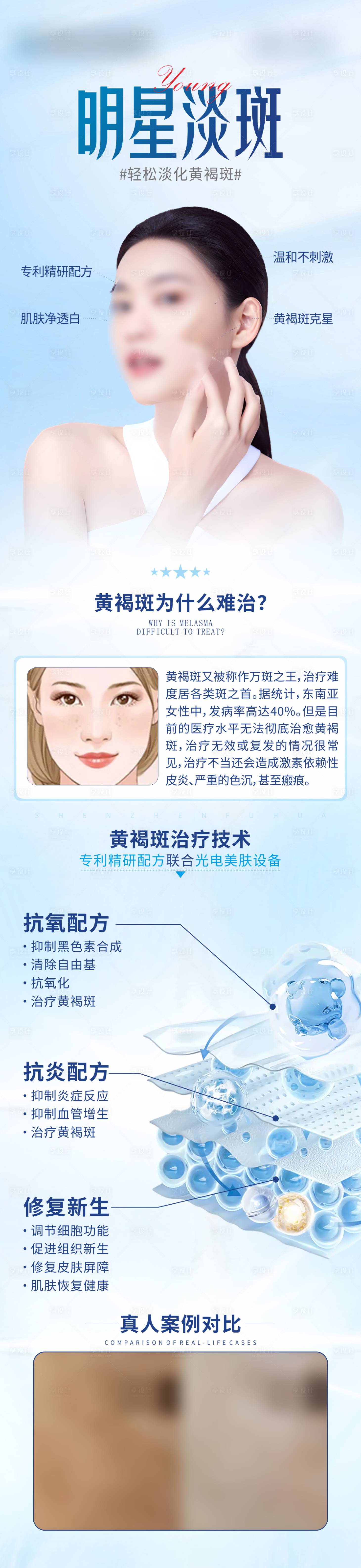 源文件下載【享設計】搜索編號：50600023057192975【明星淡斑醫美海報】