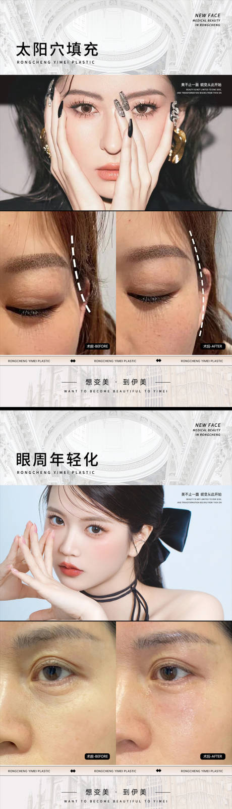 源文件下载【享设计】搜索编号：35060023527346194【医美案例对比海报】