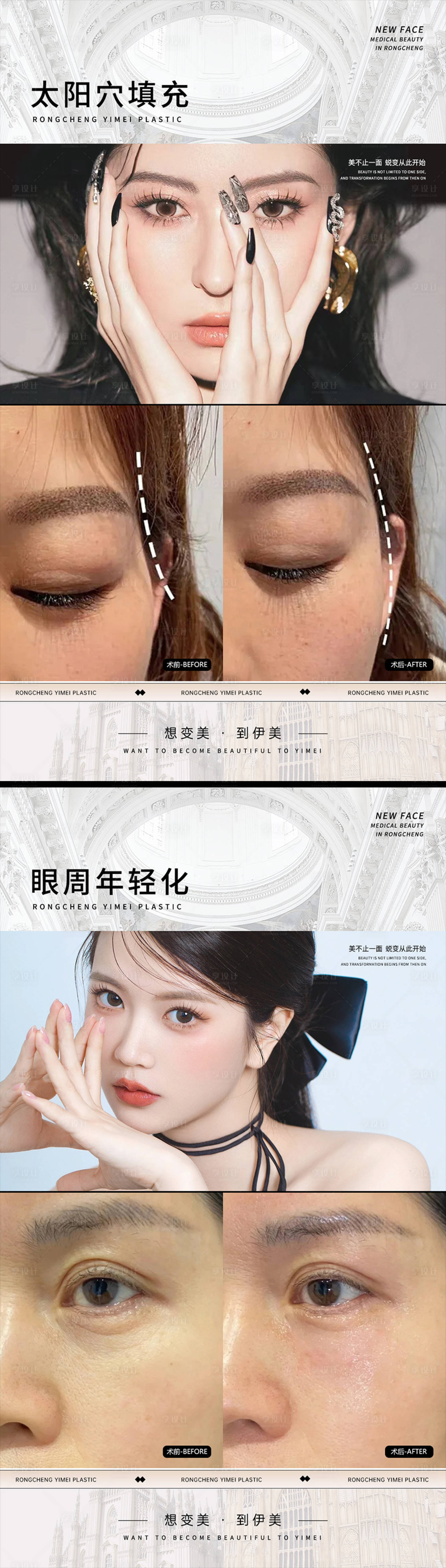 源文件下载【享设计】搜索编号：35060023527346194【医美案例对比海报】