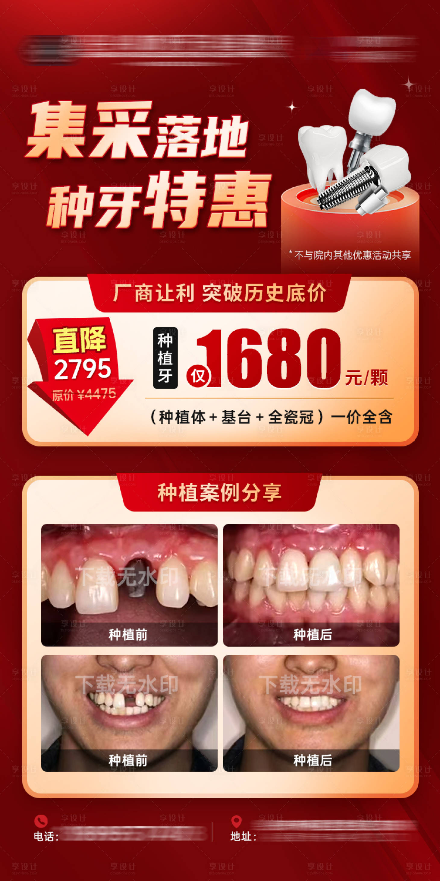 源文件下載【享設(shè)計(jì)】搜索編號(hào)：78980023140064216【種植牙集采活動(dòng)案例海報(bào)】