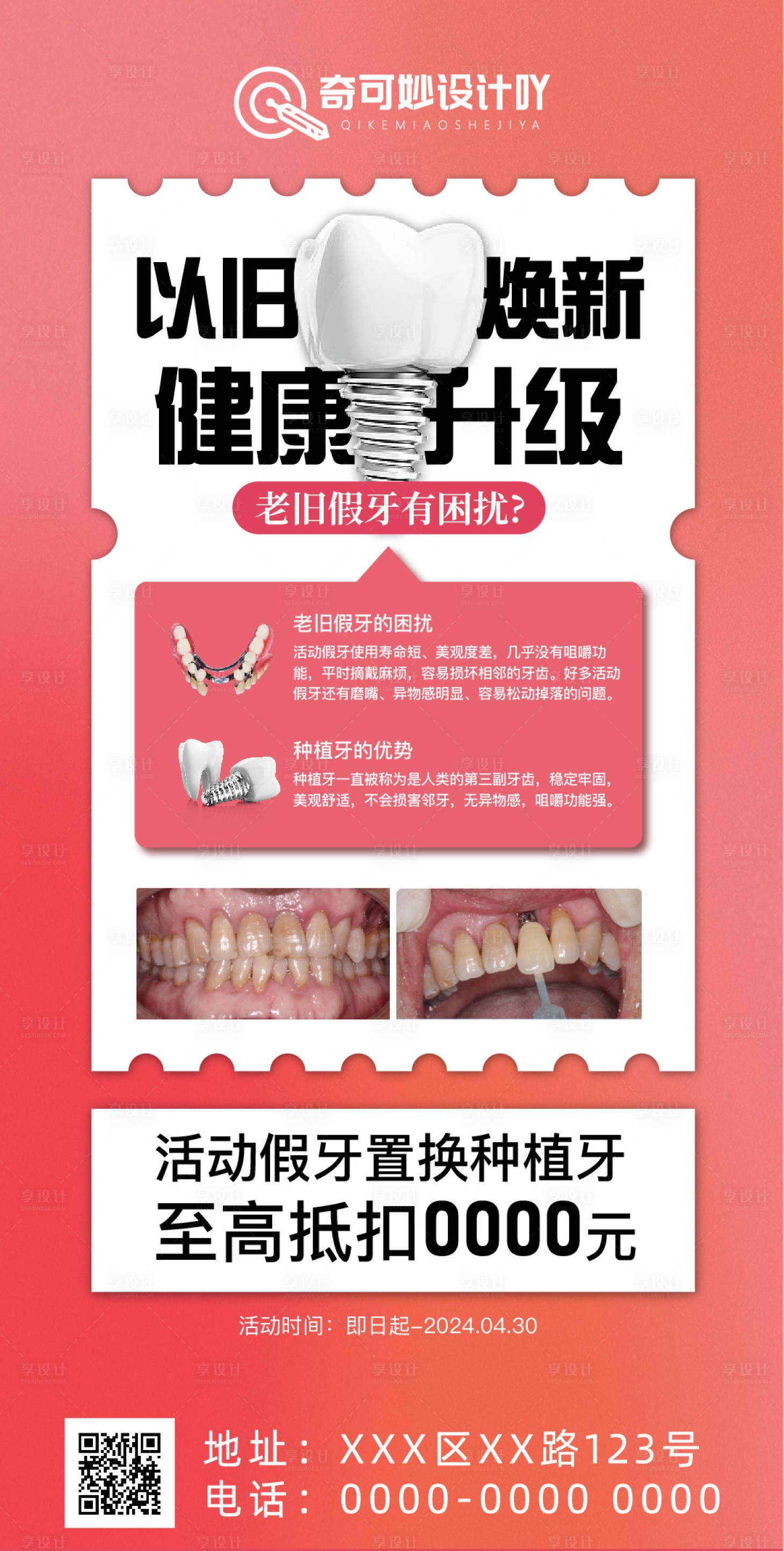 源文件下载【享设计】搜索编号：76300023047322339【口腔活动海报】