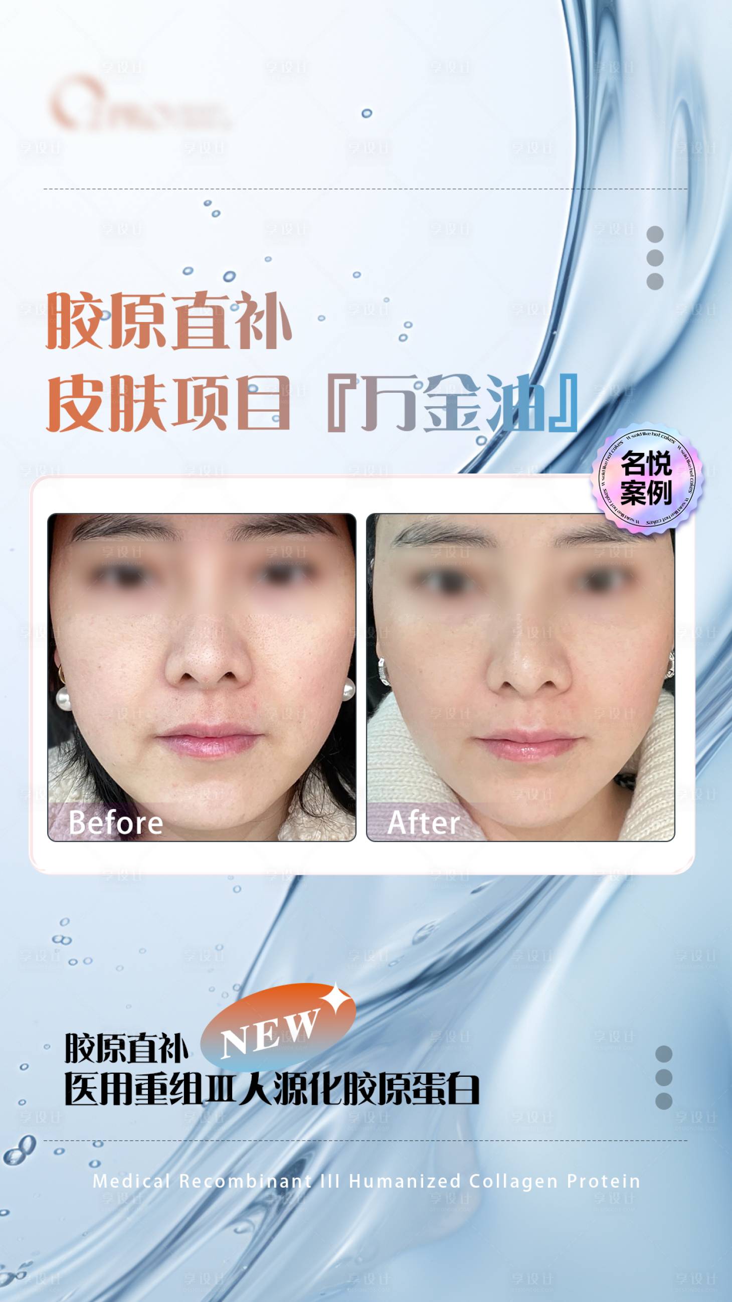 源文件下載【享設計】搜索編號：17220023613738386【膠原蛋白對比海報】