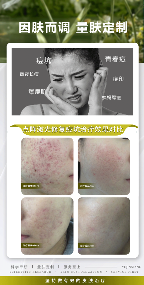 源文件下载【祛痘案例】编号：95470023396115880