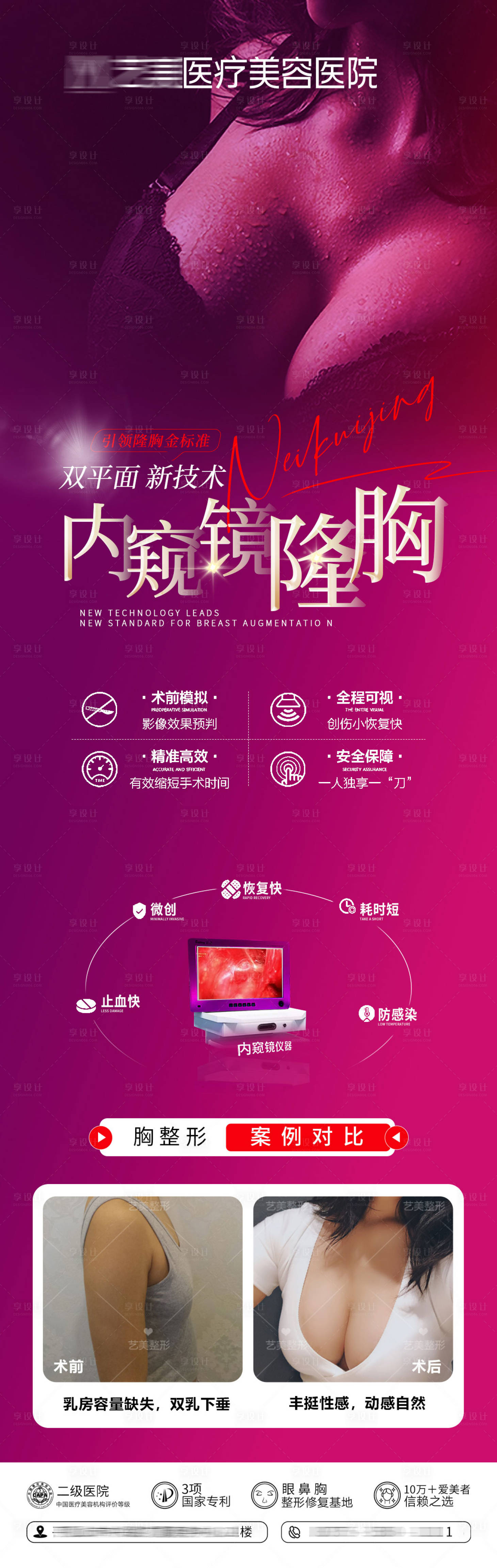 源文件下载【享设计】搜索编号：32910023240251260【医美内窥镜隆胸长图】