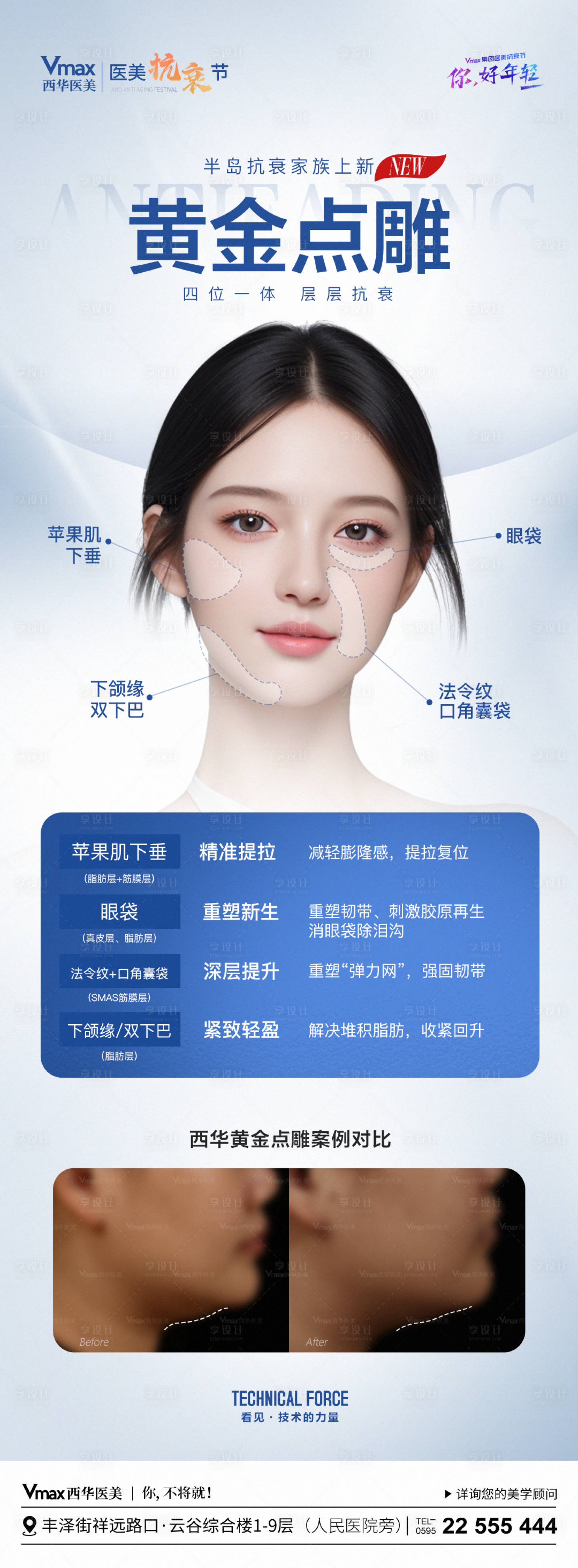 源文件下載【享設(shè)計(jì)】搜索編號(hào)：82660023586539401【醫(yī)美黃金點(diǎn)雕案例海報(bào)】