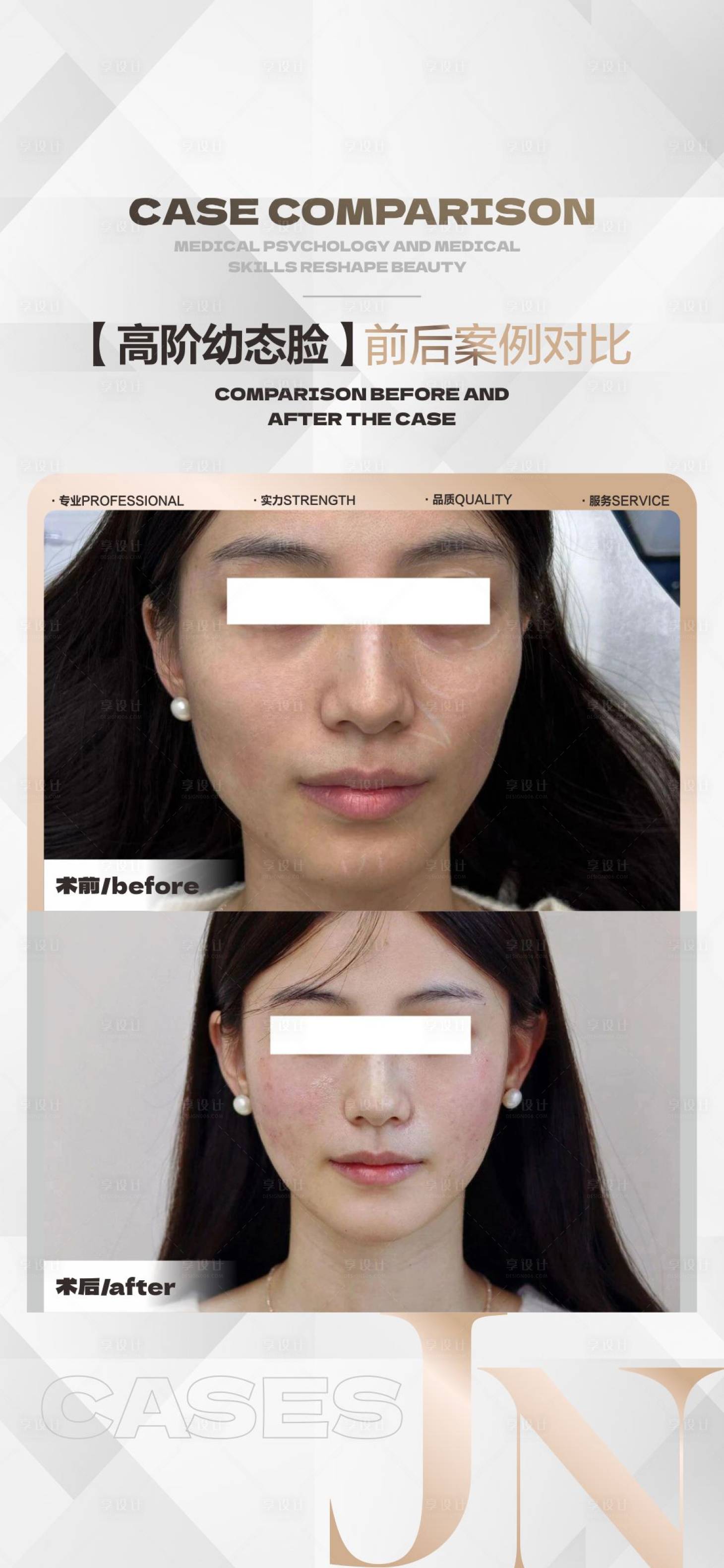 源文件下载【享设计】搜索编号：21980024096028292【医美案例海报】