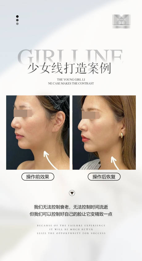 源文件下载【医美案例美业案例对比海报】编号：44340023711555230