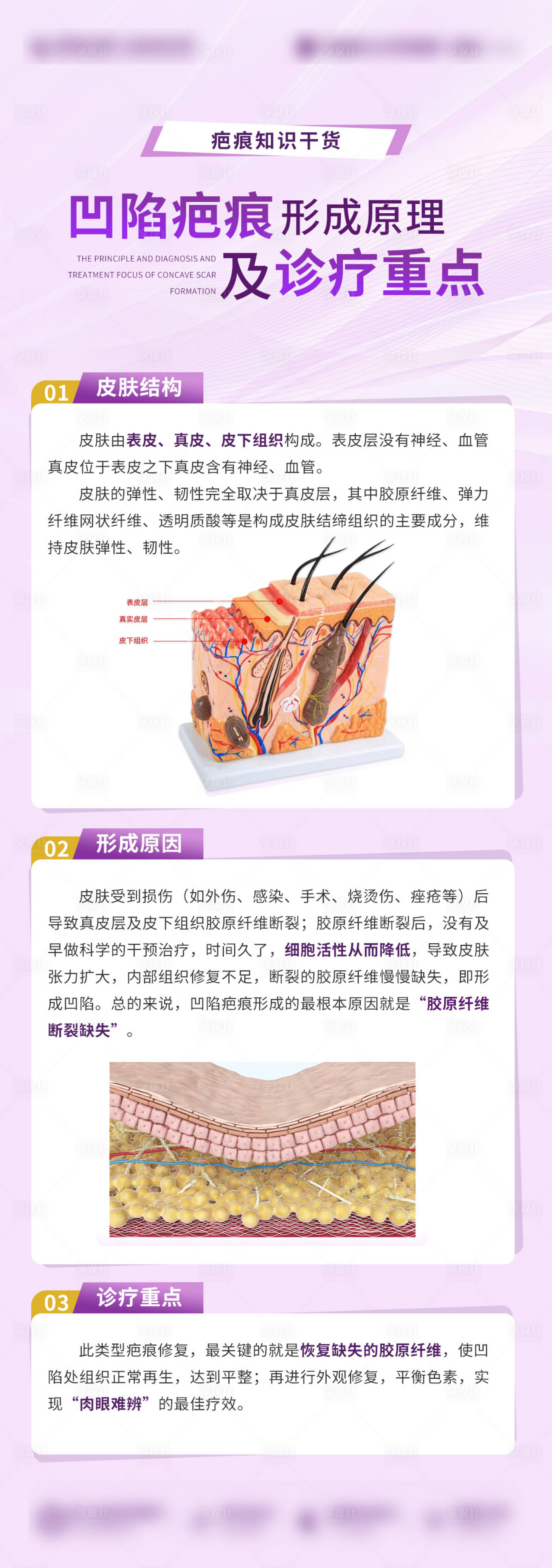 源文件下载【享设计】搜索编号：29240023974718888【疤痕科普 】