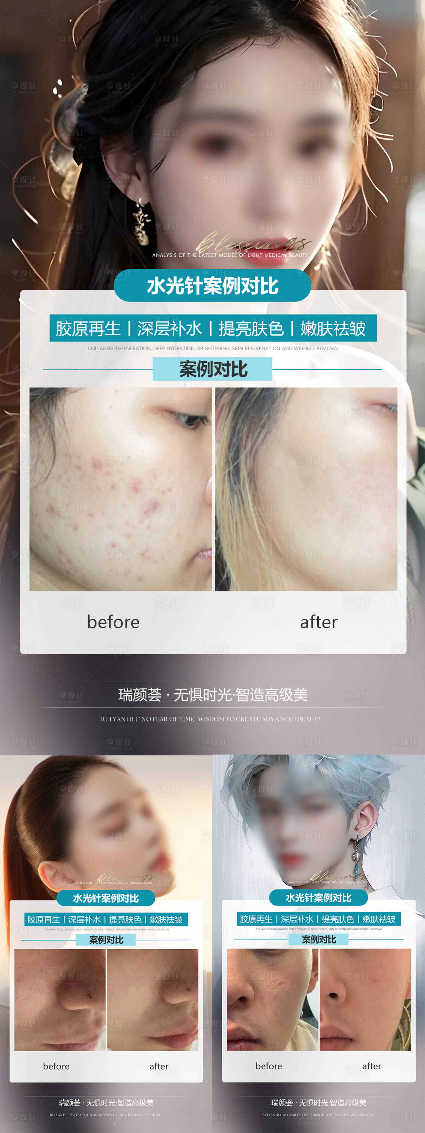 源文件下载【享设计】搜索编号：83770024120546368【水光针案例海报】