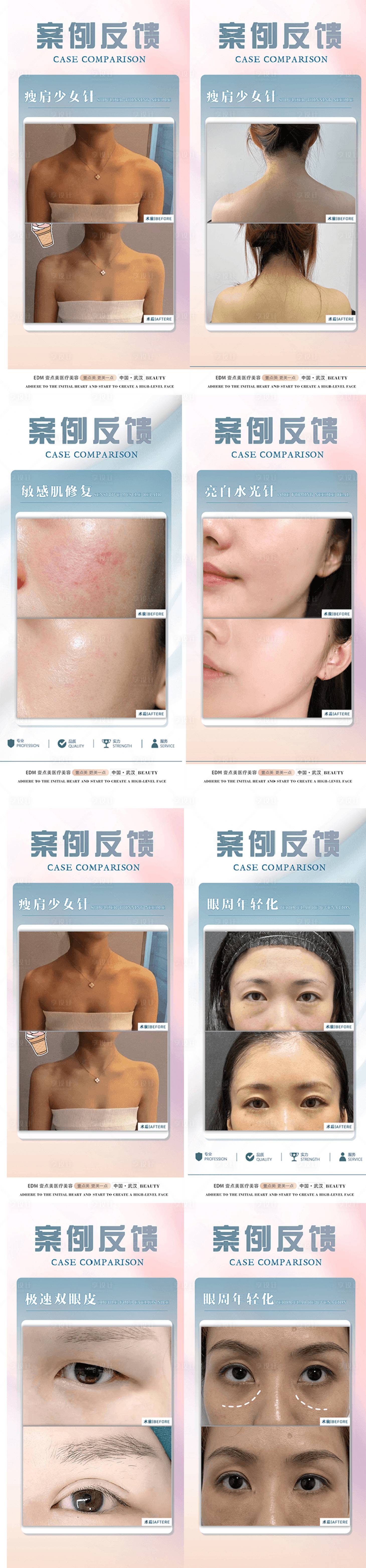 源文件下載【享設計】搜索編號：68340023775991176【醫美案例對比系列海報】