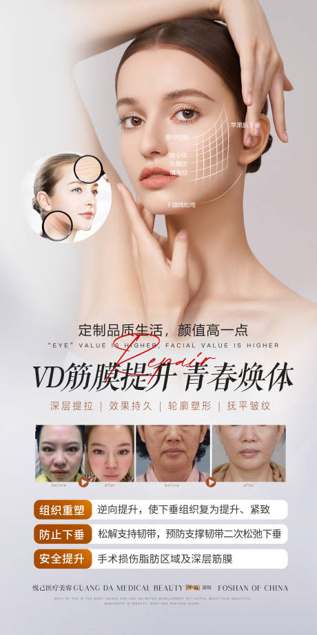 源文件下载【医美筋膜提升活动海报】编号：59640024056817421