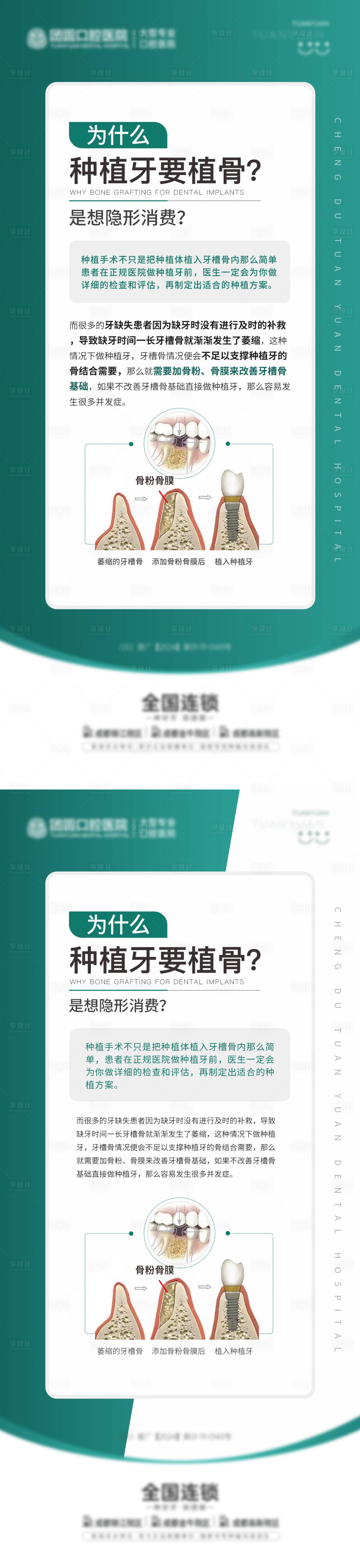 源文件下载【口腔种植牙科普】编号：28790023835198156