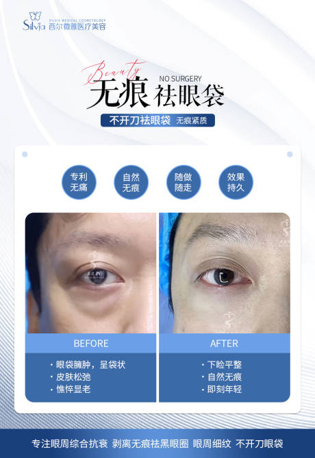 源文件下载【医美案例模板】编号：13810023976652917