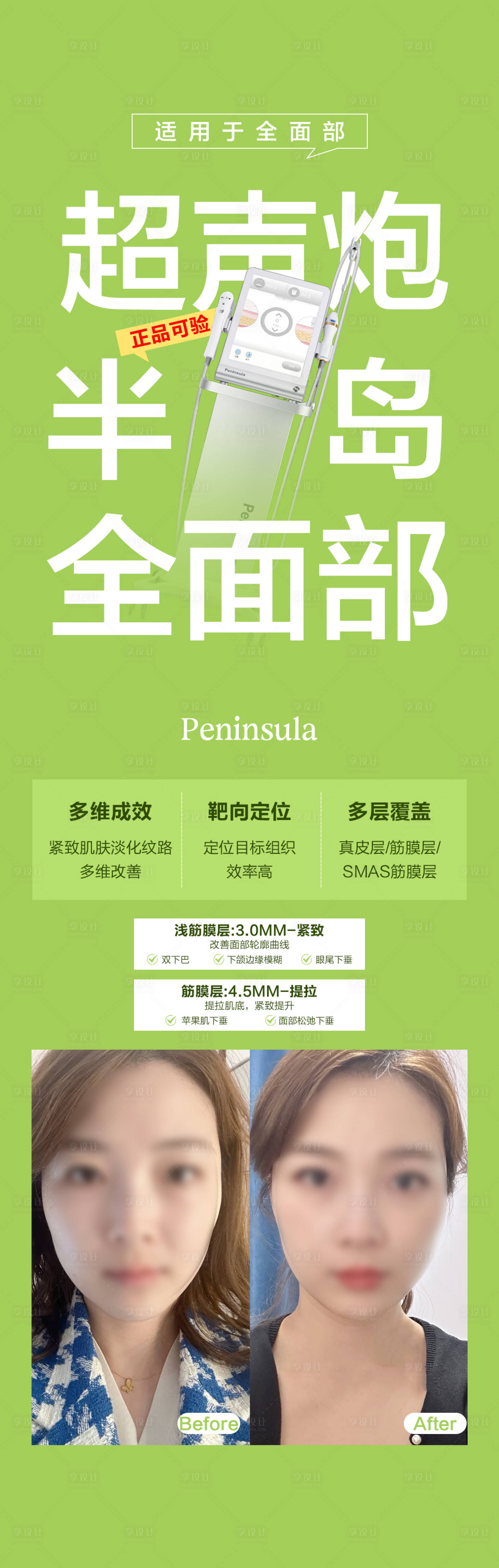 源文件下載【享設計】搜索編號：71720024059117286【超聲炮海報】
