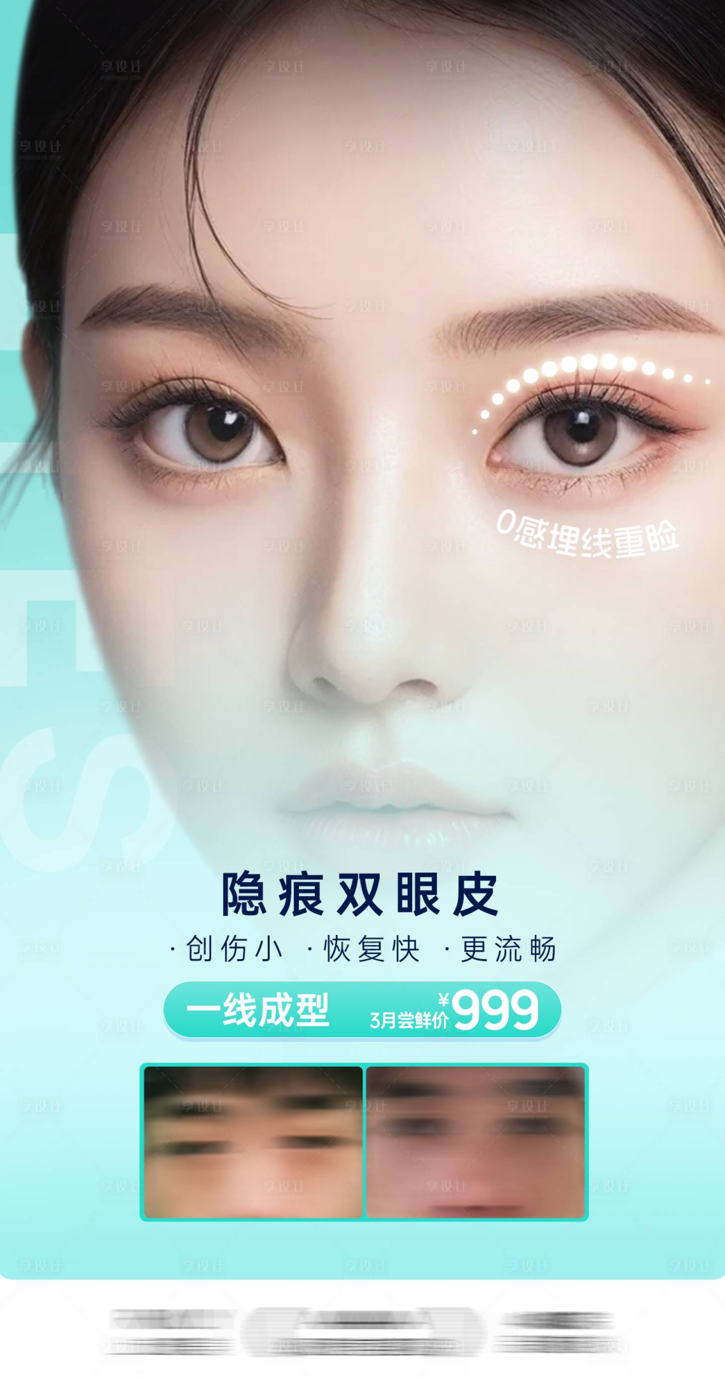 源文件下载【医美整形双眼皮海报】编号：40770023668259162