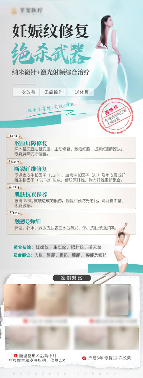 源文件下載【私密妊娠紋修復 】編號：57910024095999811