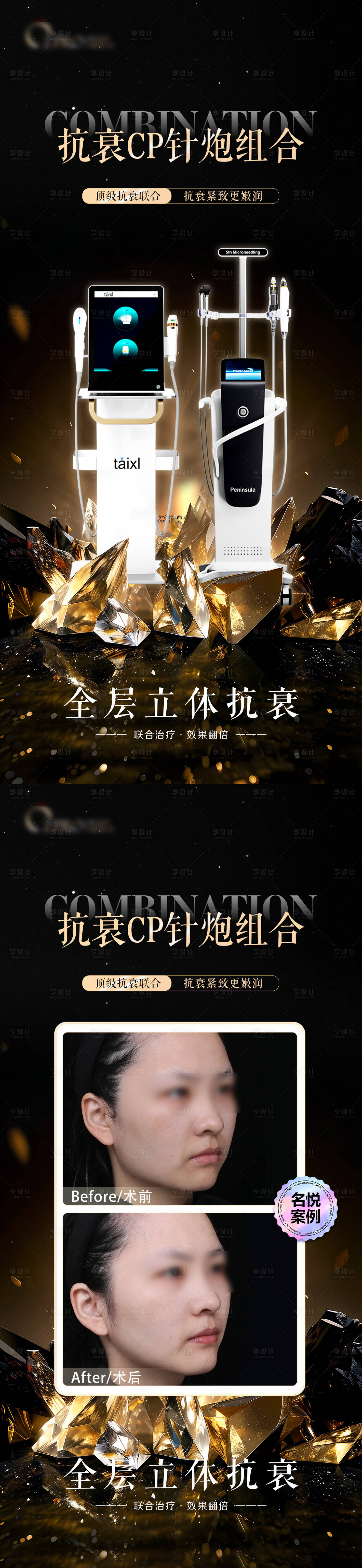 源文件下載【享設計】搜索編號：45450023744594556【黃金微針 】