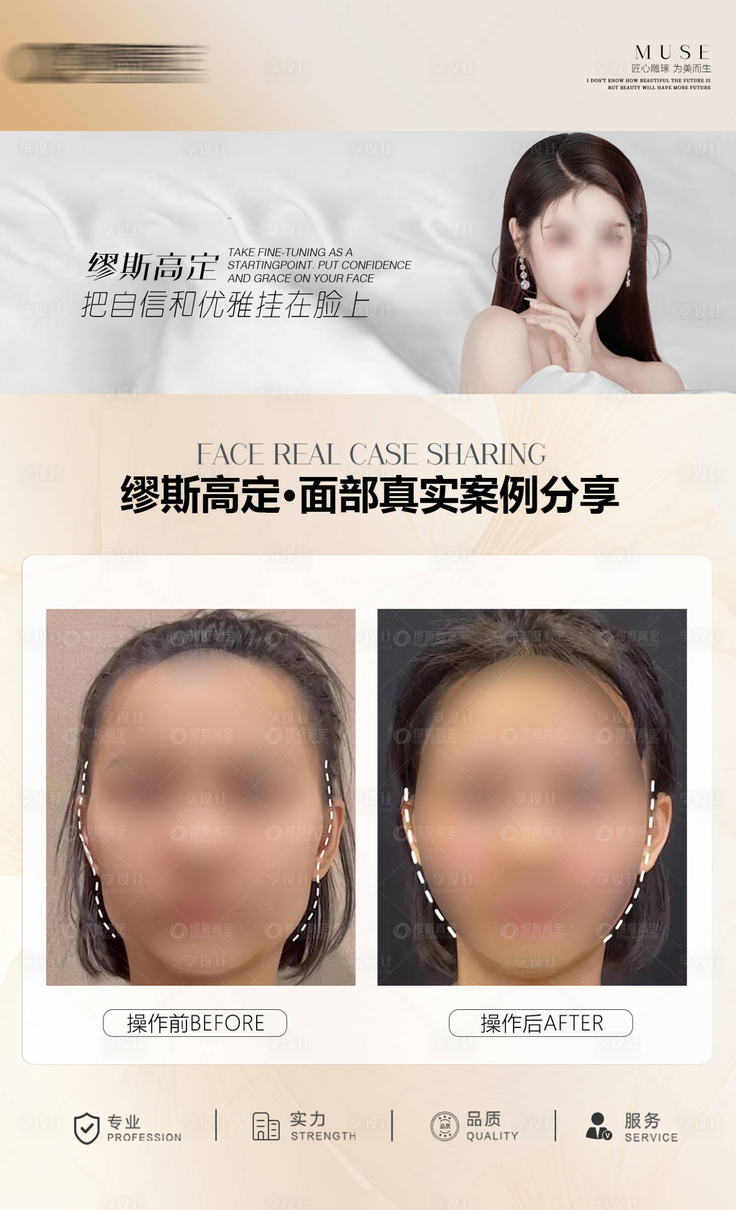 源文件下載【享設(shè)計(jì)】搜索編號：30770023988528160【醫(yī)美面部抗衰案例海報】