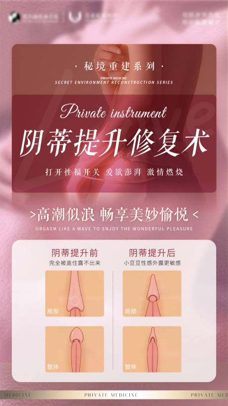 源文件下载【私密项目阴蒂提升修复术 】编号：49190024087866476