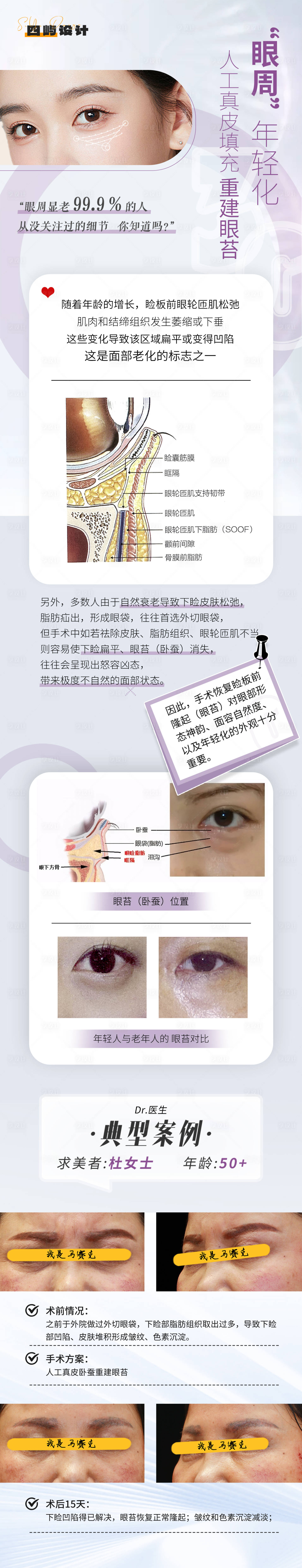 源文件下载【享设计】搜索编号：41980023758413607【眼周年轻化抗衰海报】