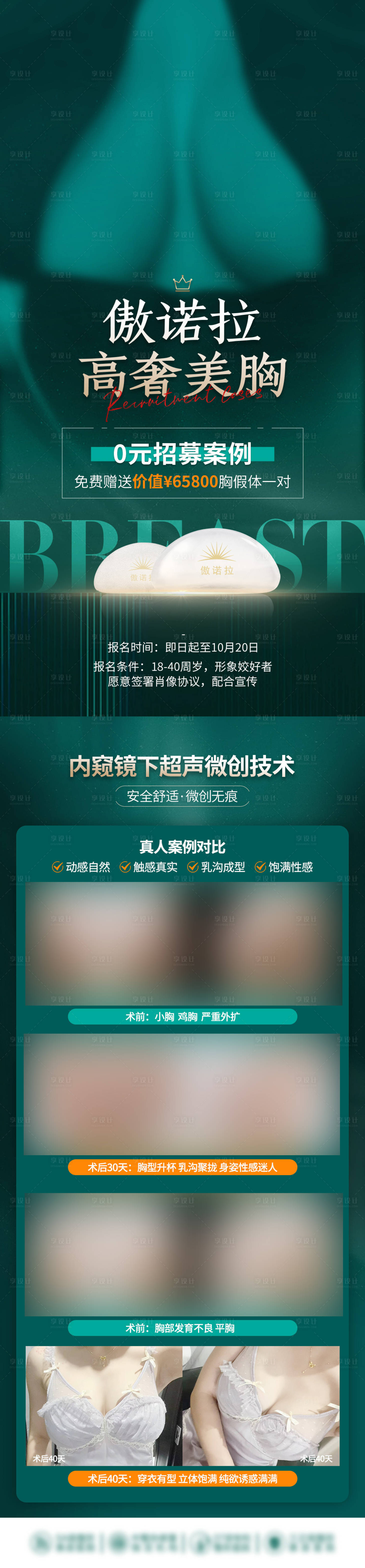 源文件下載【享設(shè)計(jì)】搜索編號：61880023591088649【醫(yī)美豐胸長圖海報(bào)】