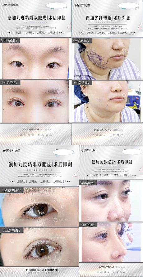 源文件下载【医美案例海报】编号：17400024165353429