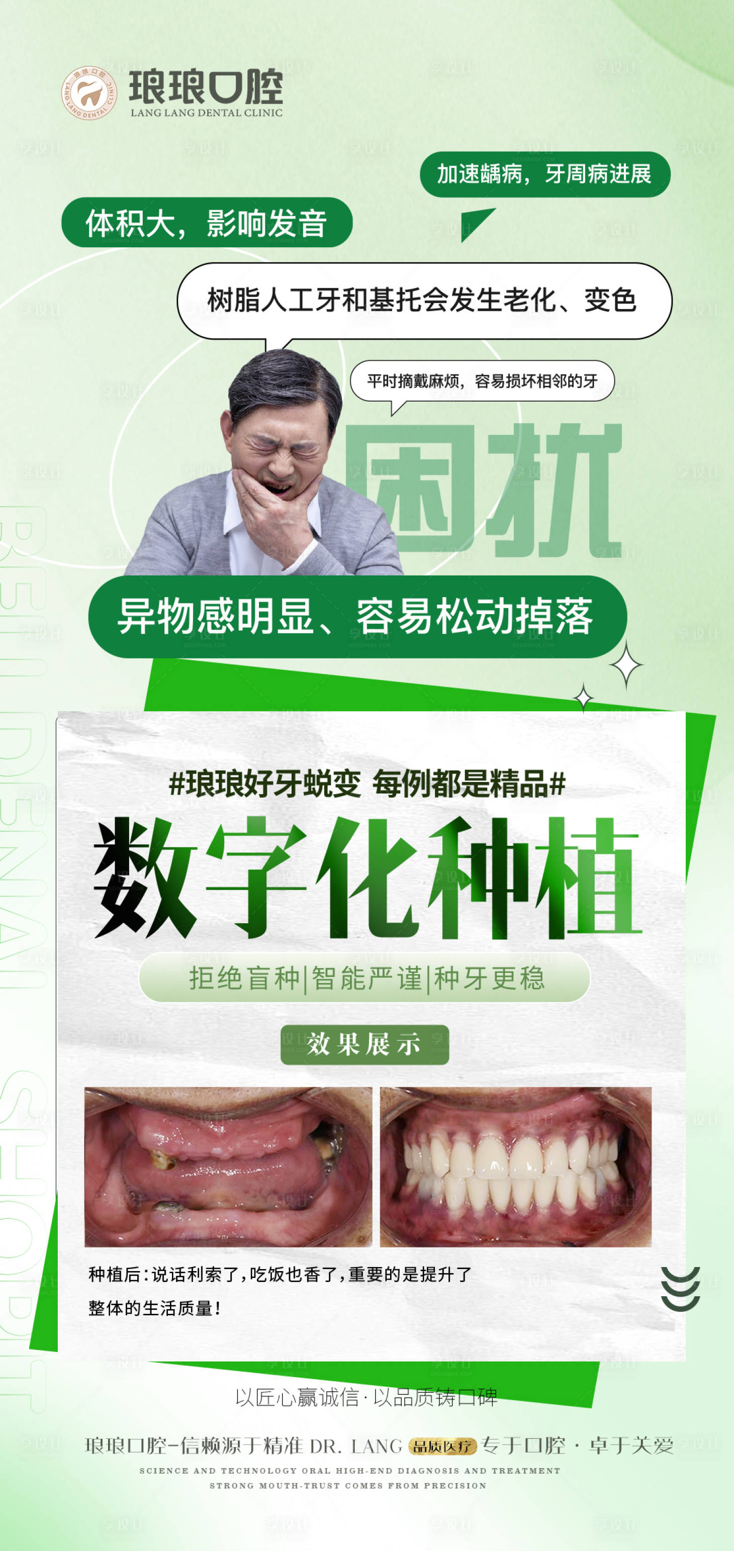 源文件下載【享設計】搜索編號：69120023741022963【口腔種植牙案例海報】