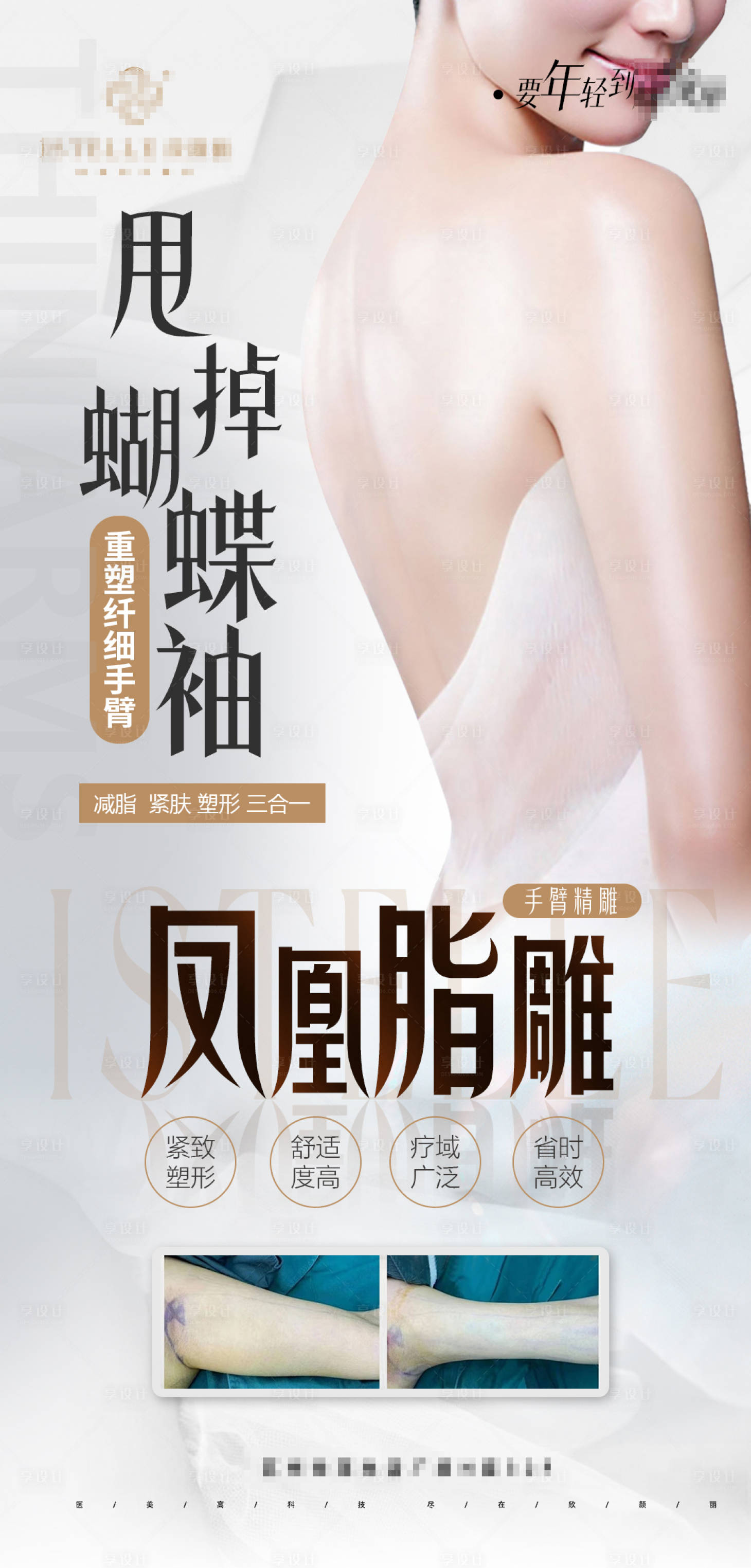 源文件下載【享設(shè)計(jì)】搜索編號(hào)：56790023903845753【手臂吸脂】