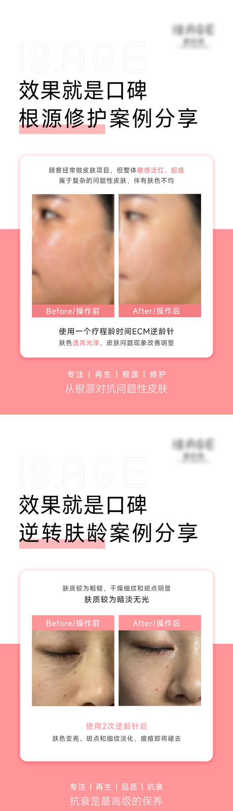源文件下载【享设计】搜索编号：46470023935937895【医美效果对比图系列海报】