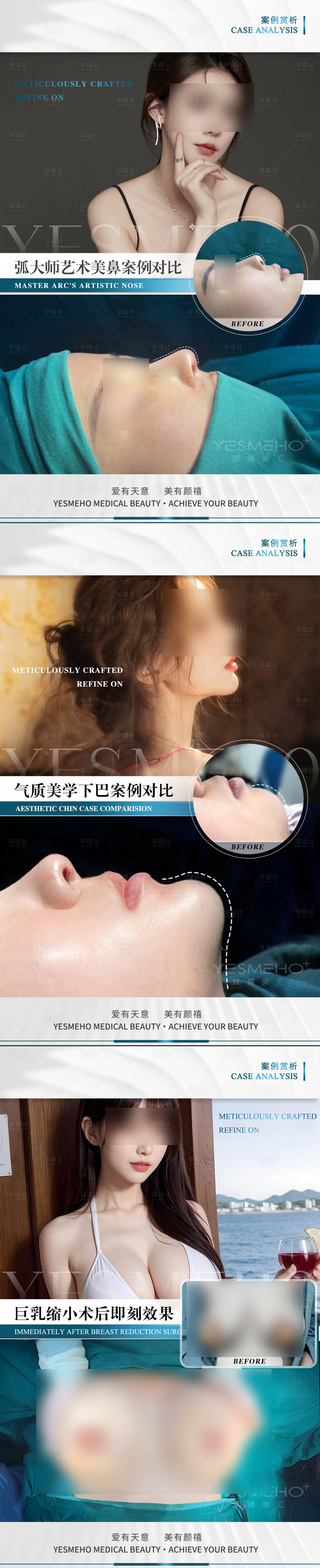 源文件下载【医美精品案例】编号：11990023945181477