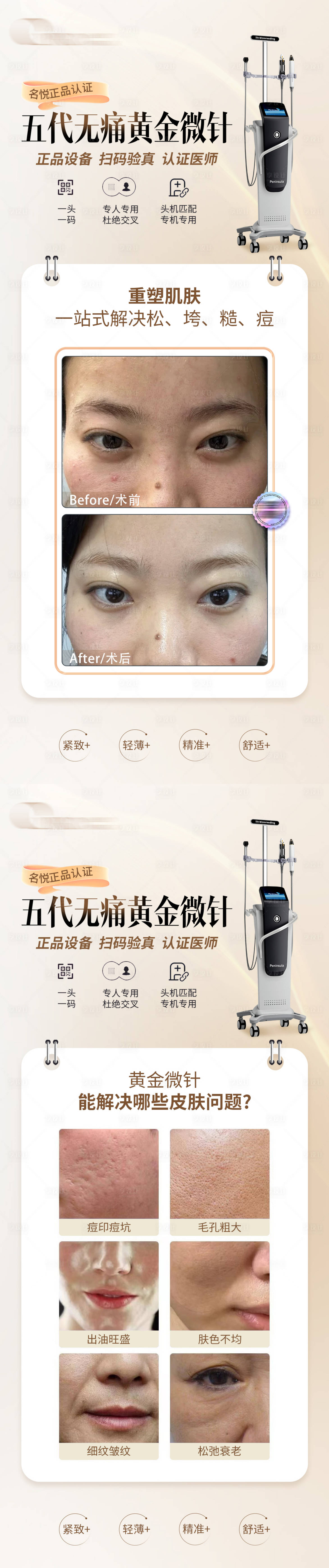 源文件下載【享設計】搜索編號：30550024222931663【黃金微針案例海報】