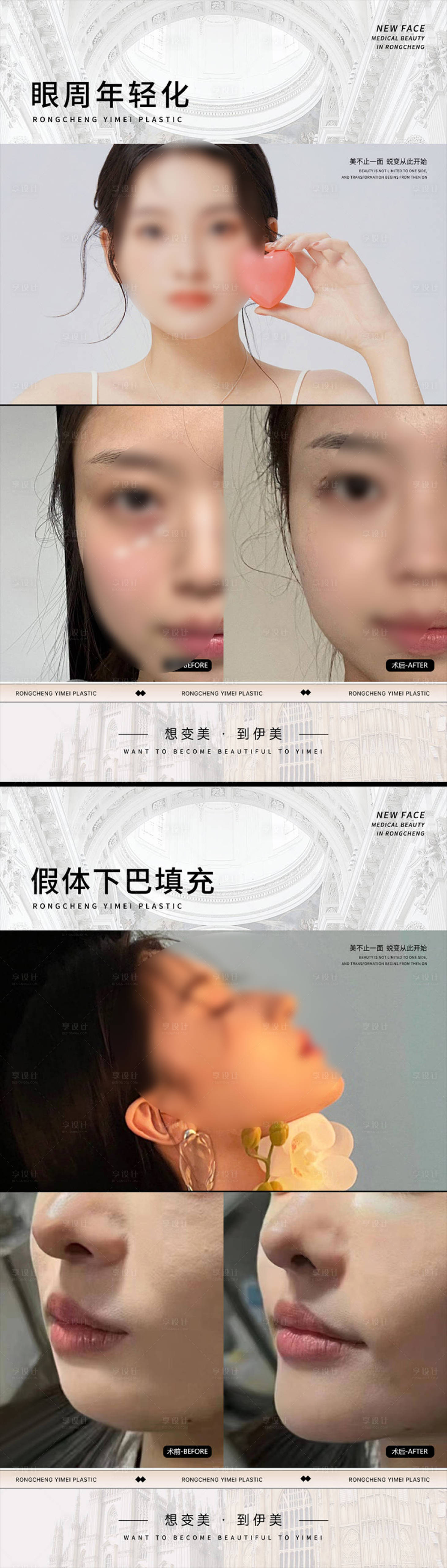 源文件下载【医美案例对比海报】编号：92270023988577923