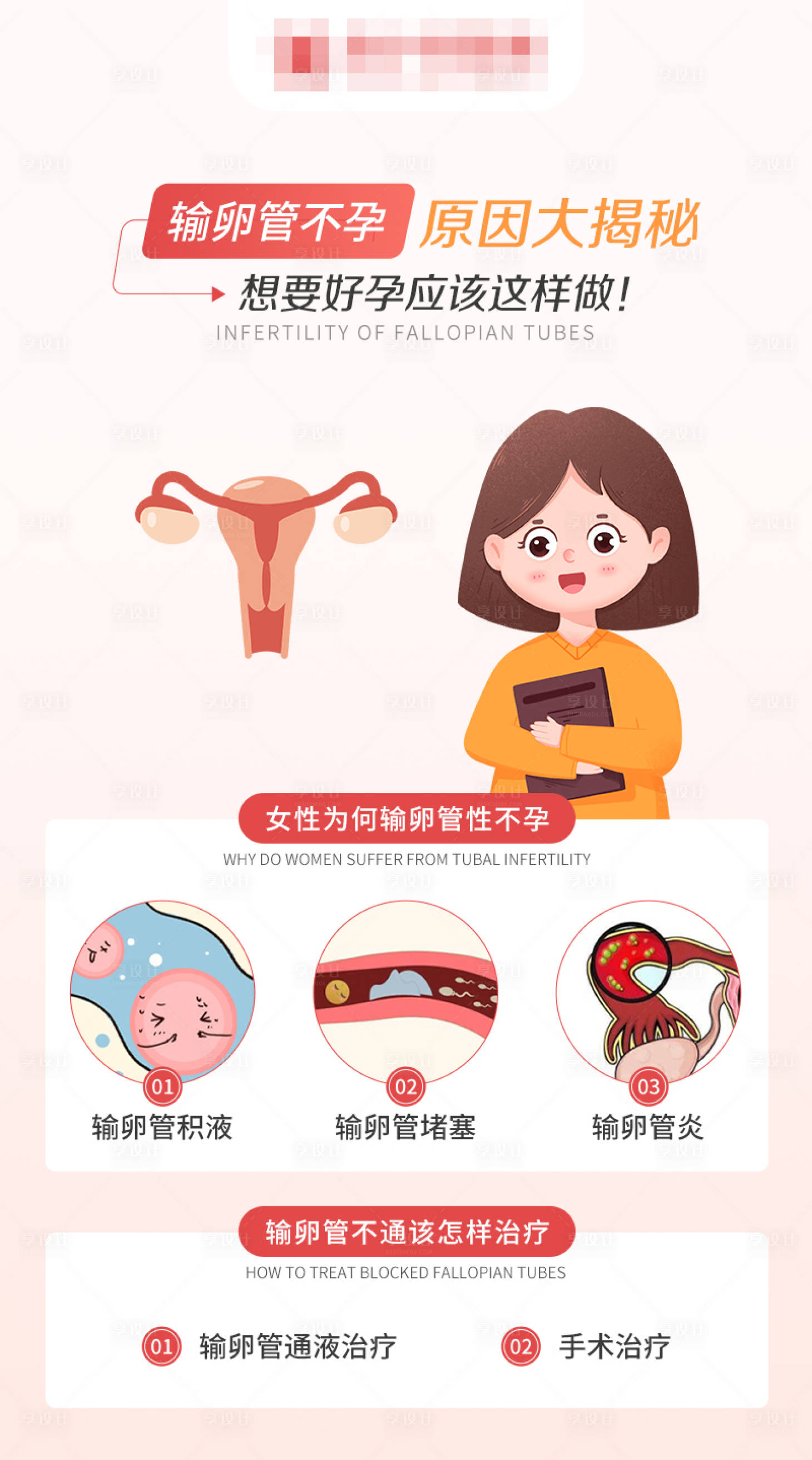 源文件下載【享設計】搜索編號：13270024030081330【輸卵管不孕原因大揭秘科普海報】