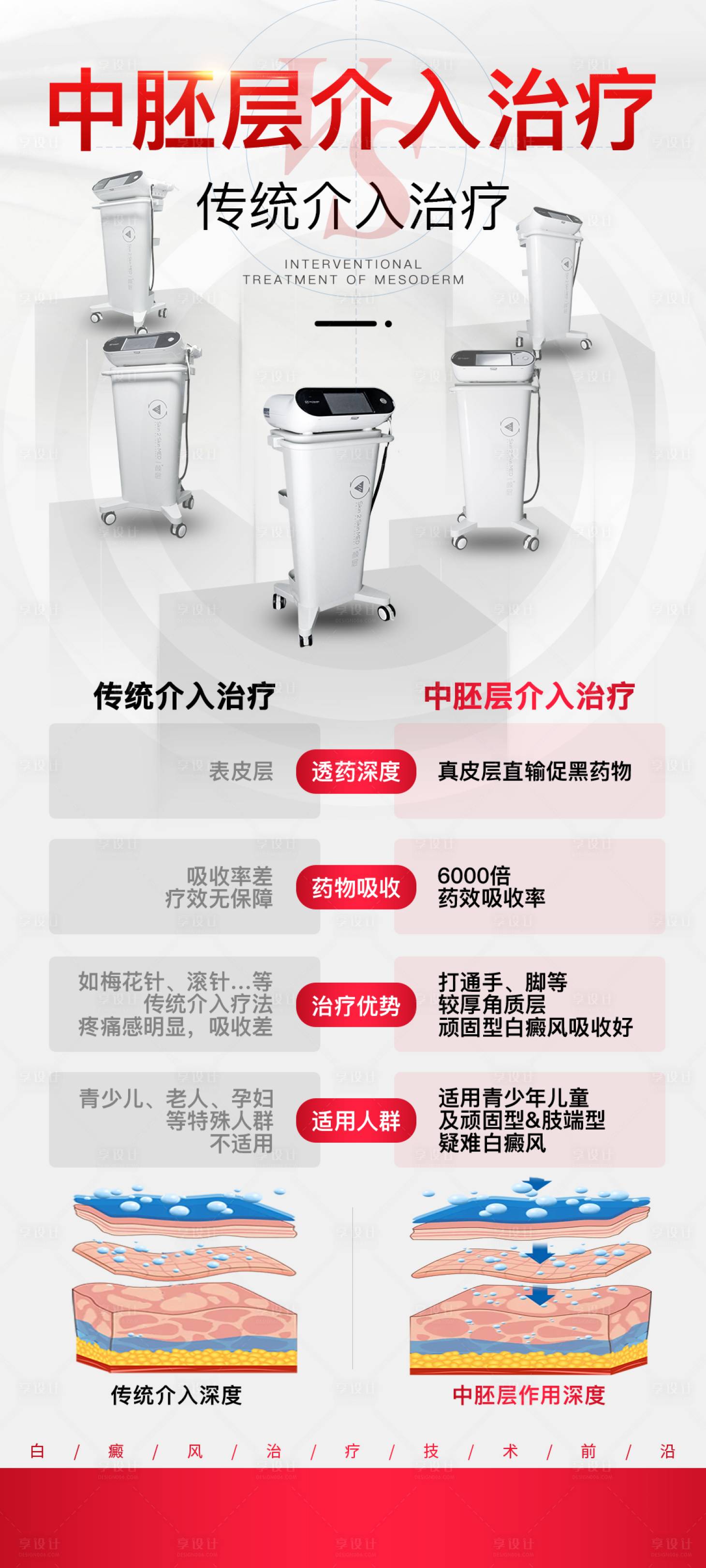源文件下載【享設計】搜索編號：50940024035526857【中胚層介入治療vs傳統介入治療】