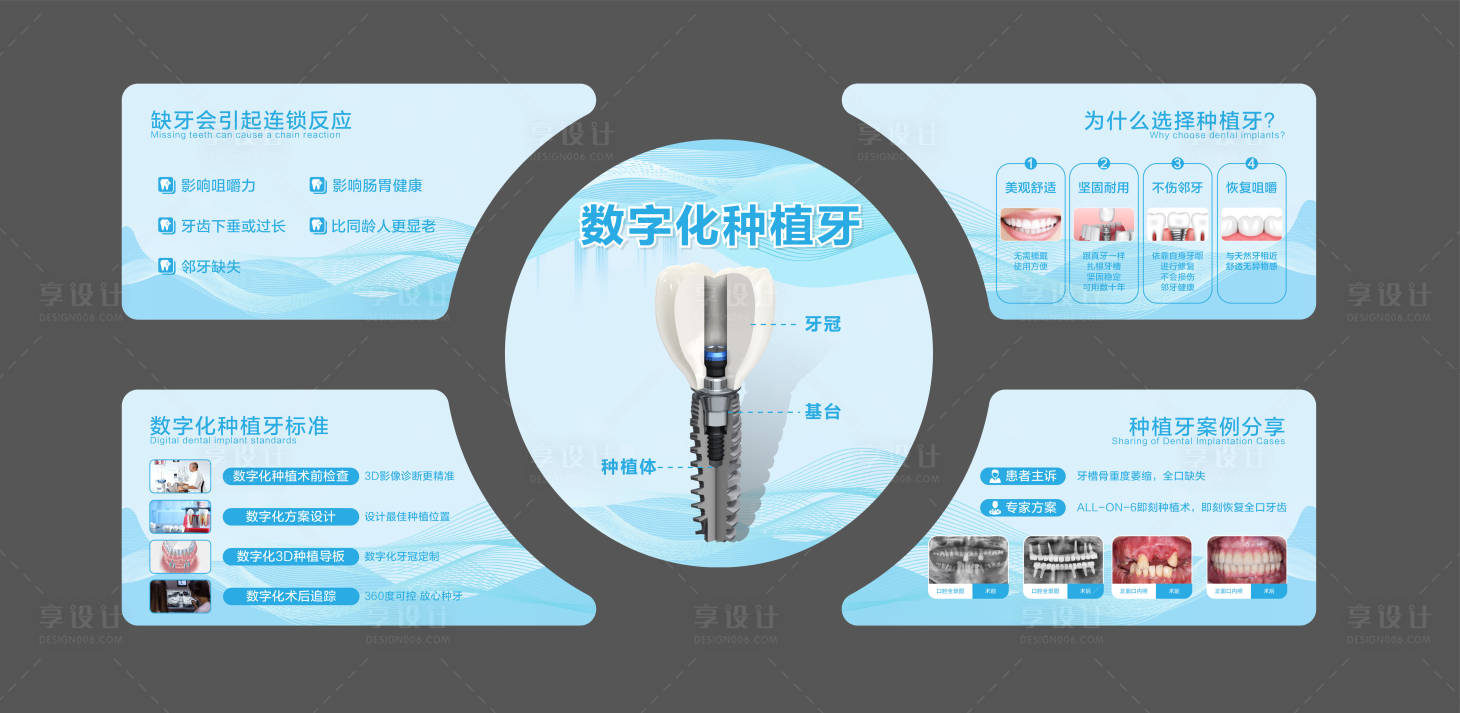源文件下载【享设计】搜索编号：77400023801801289【口腔种植牙灯箱】