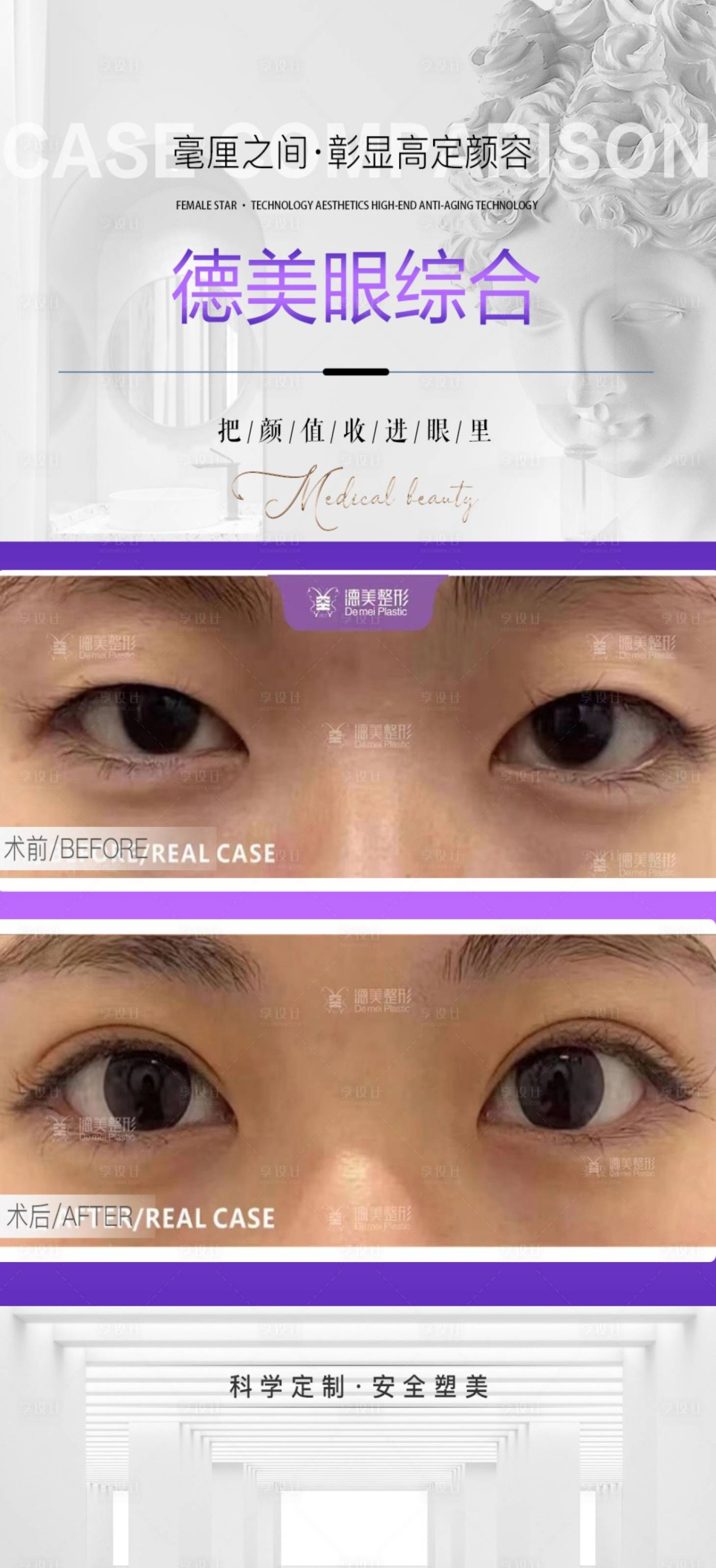 源文件下載【享設計】搜索編號：15240024222327460【眼綜合案例對比海報】