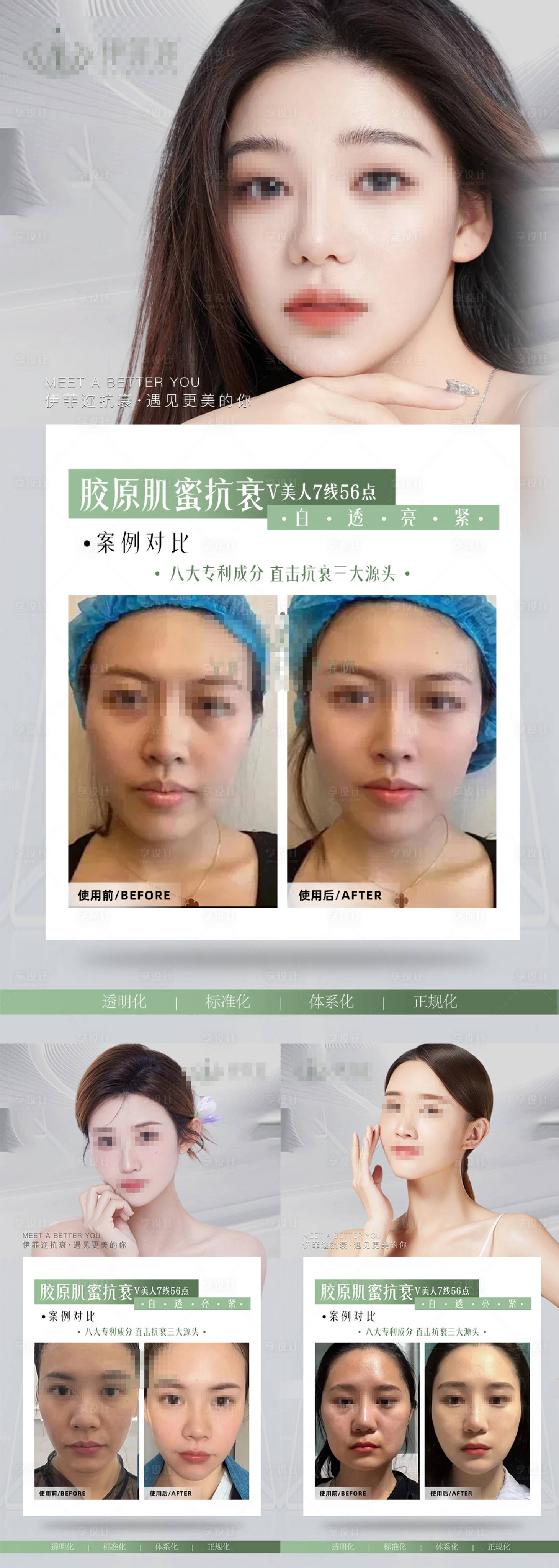 源文件下載【醫美逆齡全臉抗衰V臉打造案例對比海報】編號：89840024105225713
